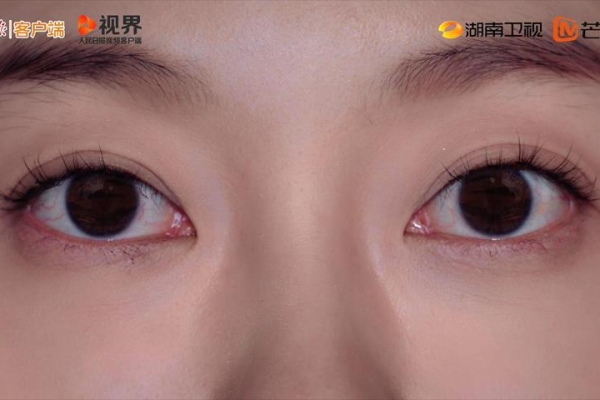 《眼睛的故事》第1集
